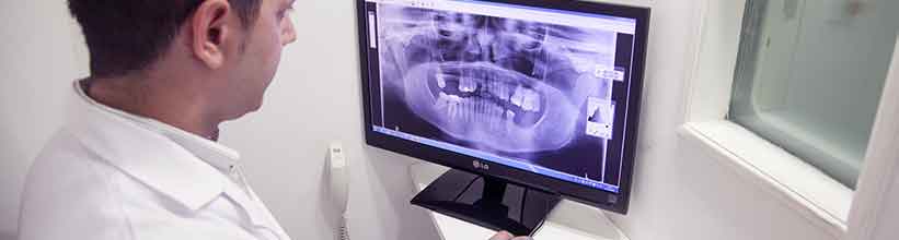 RAD365 Radiotherapy